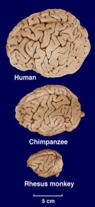 Images of brains from neurosciencelibrary.org
